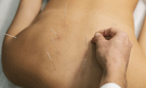 Targeted physiotherapy treatment designed to address musculoskeletal conditions, restore joint function and improve everyday movement confidence.